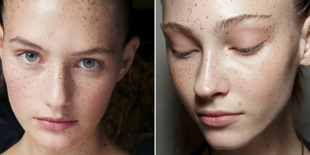 Les tâches de rousseur, une tendance beauté qui ne fait pas tâche ?
